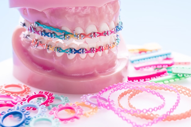 歯列矯正モデルと歯科用ツール
