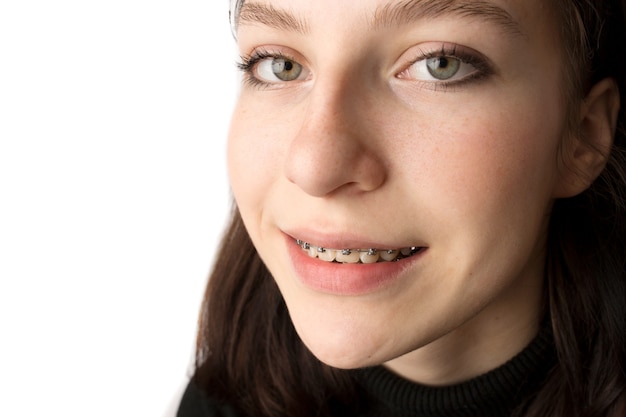 Orthodontic treatment. Dental care concept. Smiling teenage girl with braces. Metal braces close-up on the teeth. High quality photo