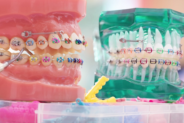 Orthodontisch model