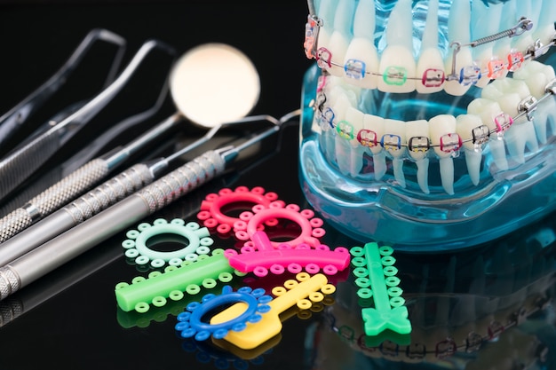 Foto orthodontische model en tandarts tool - demonstratie tanden model van verschillende soorten orthodontie