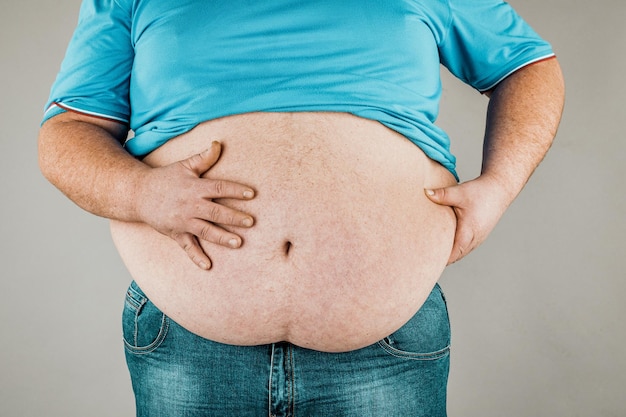 Overgewicht van het lichaam van een persoon met handen die de buik aanraken Het concept van zwaarlijvigheid