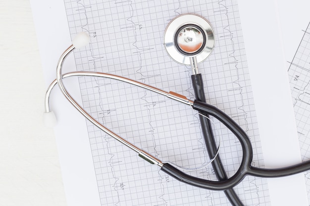 An overhead view of stethoscope on ecg medical report