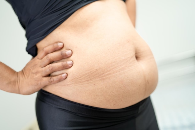 Overweight Asian woman show fat belly at office.