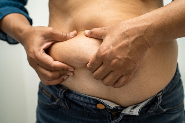 Overweight Asian woman show and use hand to squeeze fat belly