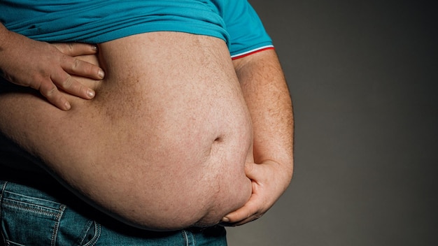 写真 腹部に手を触れる人の体の太りすぎ肥満の概念