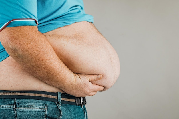 Overweight of a person's body with hands touching the abdomen The concept of obesity