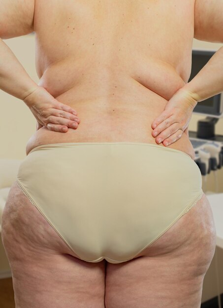 사진 의사 의 치료실 에서 과체중 을 가진 여자