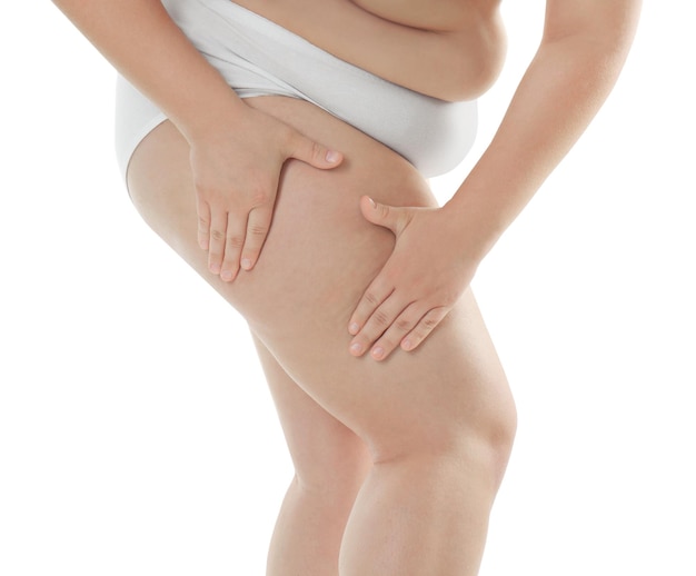 overweight young woman in underwear on white background diet concept