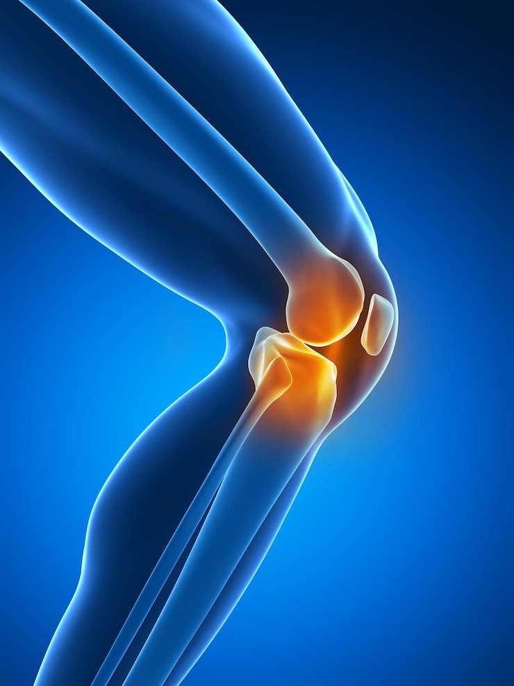 Photo painful knee