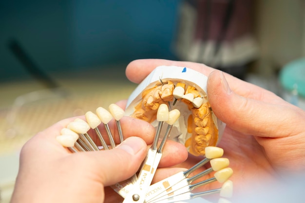 A palette for determining the color of teeth in the hands of a dental orthopedist