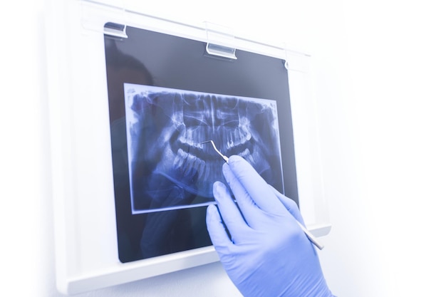 Photo panoramic dental xray