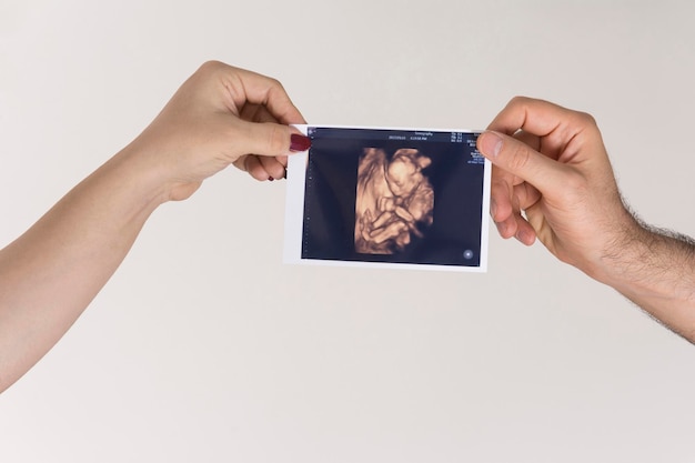 Parent holding unborn baby sonography image in hands, in front of white background.