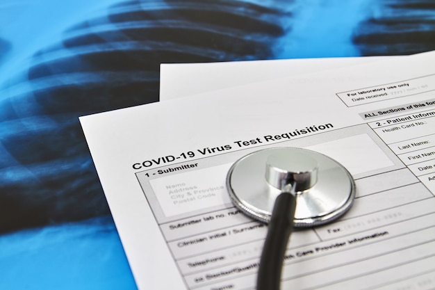 COVID-19 바이러스 테스트 요청 양식 및 청진기의 일부입니다. 코로나 바이러스 보호 개념. 확대