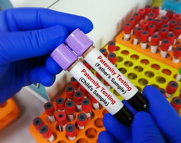 Paternity testing by DNA sequencing of Father's and children's blood sample