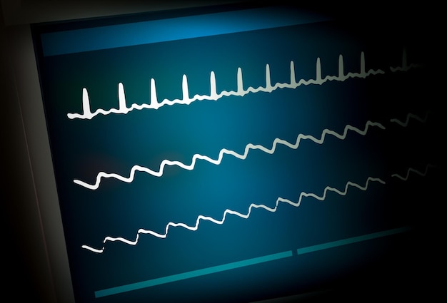 Фото Монитор пациента, показывающий жизненно важные признаки экг и экг