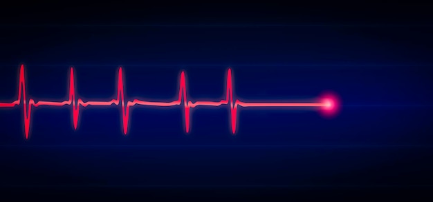 활력 징후 ECG 및 EKG 벡터 일러스트 레이 션을 보여주는 환자 모니터