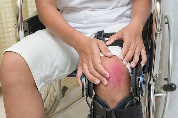 휠체어에 앉아있는 환자는 무릎 통증으로 고통받습니다.