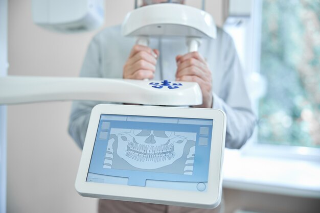 a patient standing behind a control switch of a paniramic x-ray machine