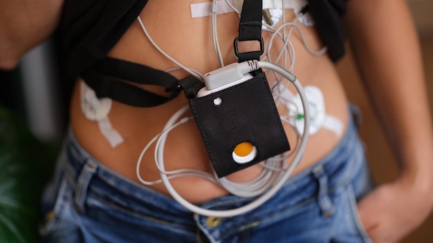 Patient standing with holter electrocardiogram monitor closeup