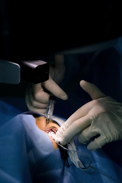 Patient and team of surgeons in the operating room during ophthalmic surgery Eluma of the century Lasik treatment Patient under sterile cover