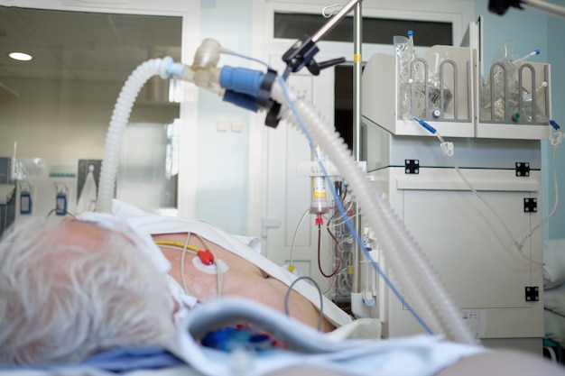 写真 コロナウイルス肺炎の患者。集中治療室の昏睡状態にある人工呼吸器の下に挿管された高齢者。