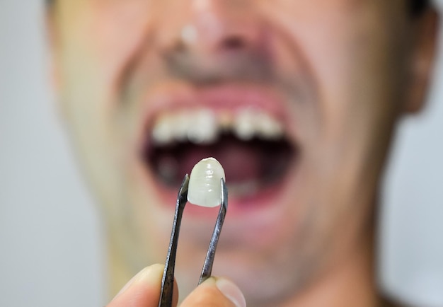 patient without a tooth is trying on a denture