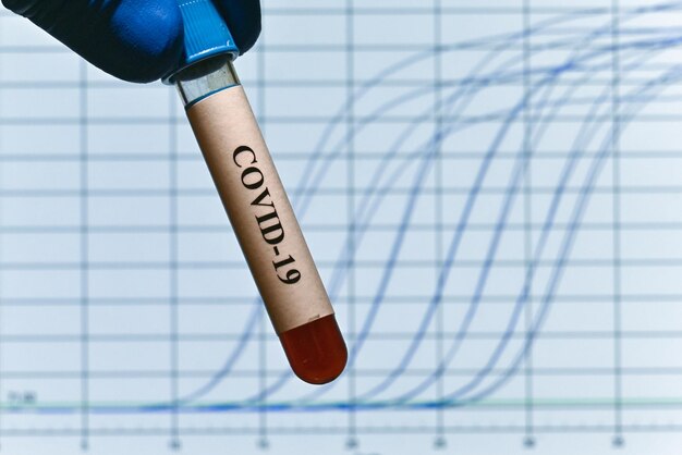 PCR diagnostics COVID19