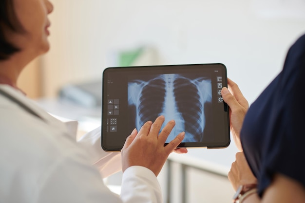 Pediatrician showing lungs xray