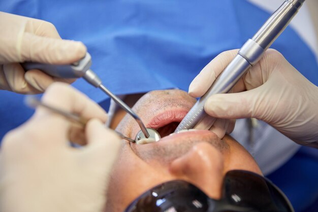 People, medicine, stomatology and health care concept - close\
up of dentist and assistant hands with dental mirror, drill and air\
water gun spray treating male patient teeth at dental clinic