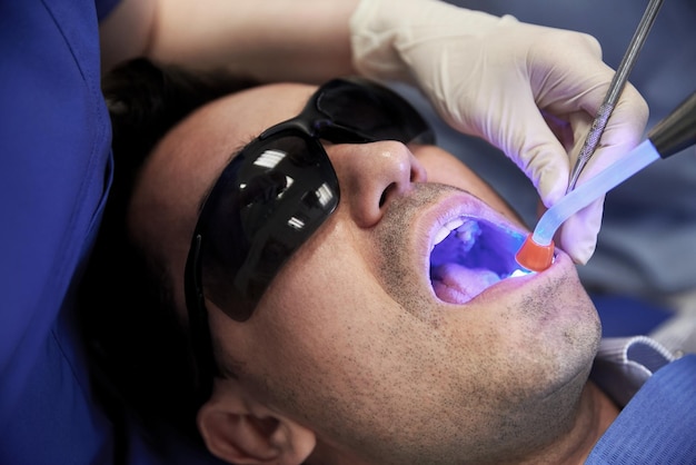 people, medicine, stomatology and health care concept - close up of dentist hand with dental curing light and mirror treating male patient teeth at dental clinic office