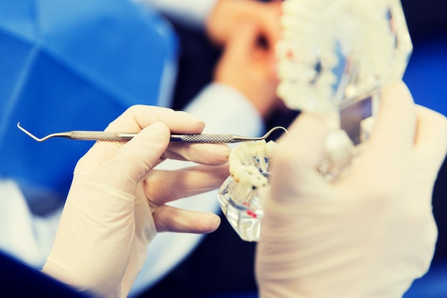 사람, 의학, 구강학 및 건강 관리 개념 - 치과 진료소에서 턱이나 치아 레이아웃 및 치과 프로브로 치과 의사의 손을 닫습니다.