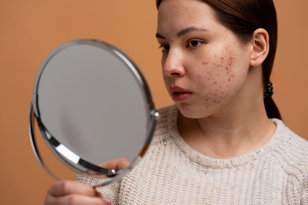 Foto persona che si occupa di rosacea