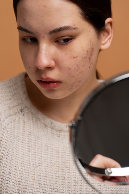 Foto persona che si occupa di rosacea