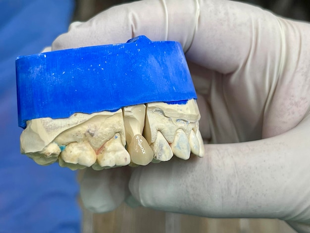 a person is holding a blue tooth that has the teeth missing