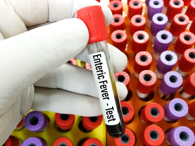 A person is holding a test tube that says " encircling ".