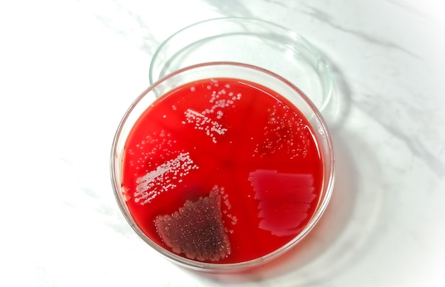 Petri dish isolated with Bacterial colony on blood agar medium. Microbial culture. white background.