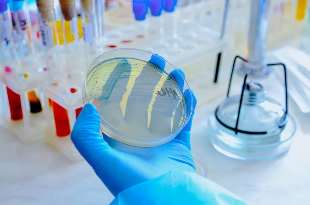 Petri dish. Microbiological laboratory. Mold and fungal cultures.