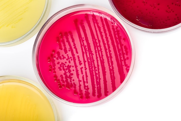 Petri dish with bacterial colonies on base, close-up view