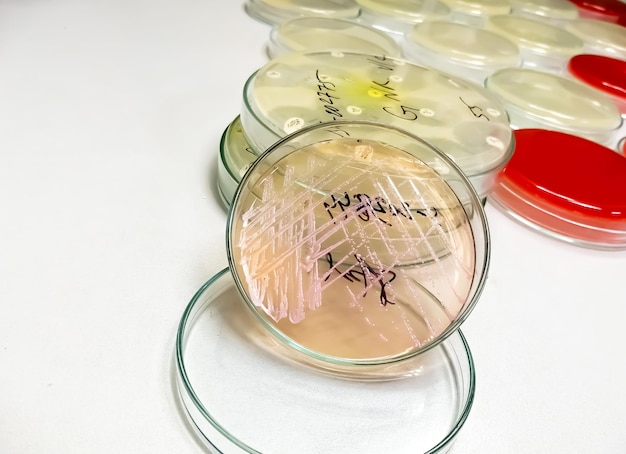 Petri dish with bacterial colony isolated in the background of a microbiology laboratory.