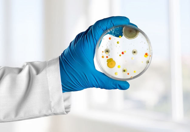 petri dish with developing mold specimen held by a hand in a blue rubber glove and a white lab coat