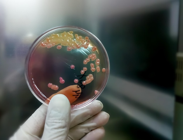 Petri dish with stool culture in microbiological laboratory