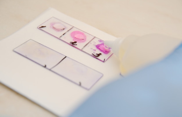 Petri dishes in the bacteriological laboratory