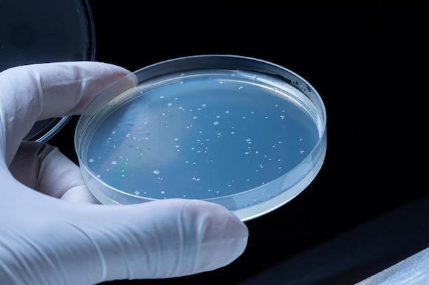 Petrischaal met bacteriekolonies of schimmels Ronde laboratoriumapparatuur met blauwe solide monster in de hand gehouden met witte steriele handschoen Zwarte achtergrond Medisch laboratorium medisch glaswerk concept