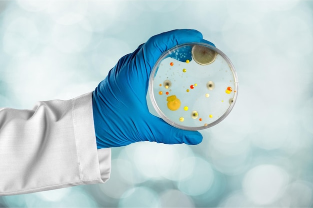 petrischaaltje met een ontwikkelingsschimmel exemplaar vastgehouden door een hand in een blauwe rubberen handschoen en een witte laboratoriumjas