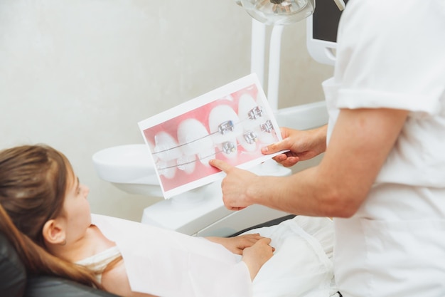 Photo of dental care Orthodontic treatment the dentist shows the girl an example of installing braces on her teeth