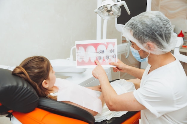 치과 치료 사진 교정 치료 치과 의사는 소녀에게 치아에 교정기를 설치하는 예를 보여줍니다