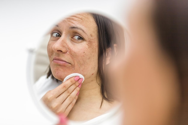 Photo photo of woman having skin problems looking in the mirror