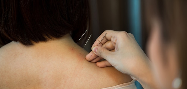 Photo the physiotherapist is doing acupuncture on young women.