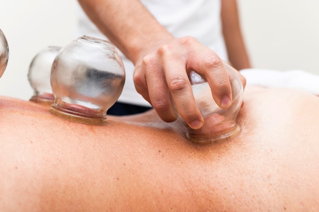 Photo physiotherapist using cupping method on female patient's back