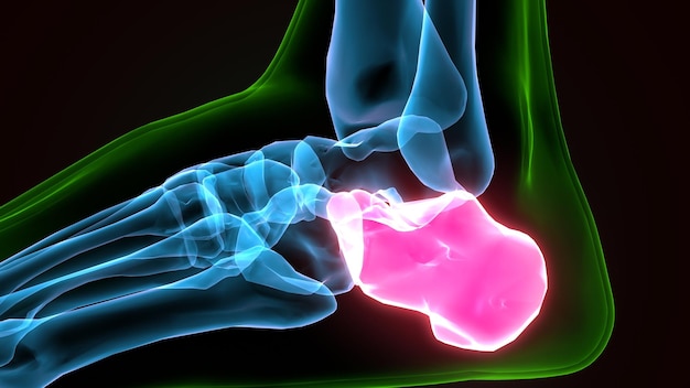 a picture of a persons foot with a green background